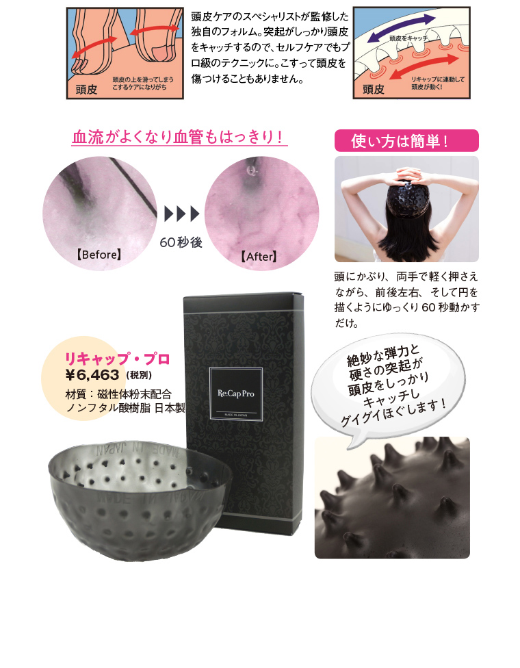 リキャップ